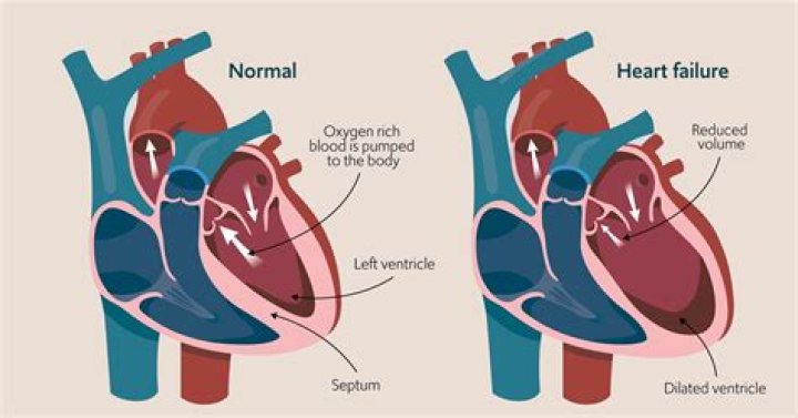 Can you still work with heart failure?