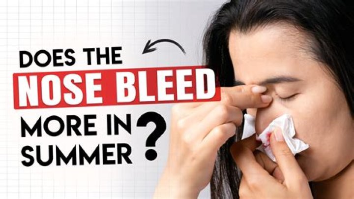 Can your nose bleed from diving?