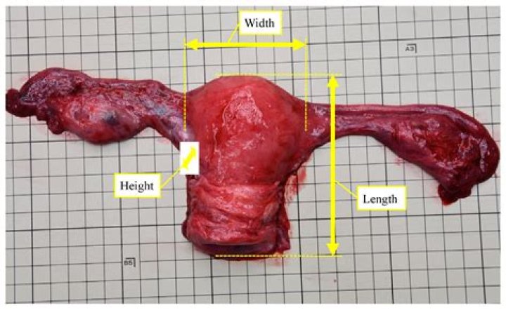 Can your uterus swell?