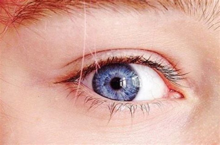Did blue eyes come from inbreeding?
