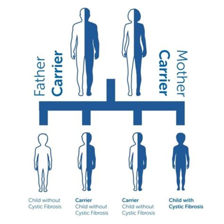 Did Prince carry the gene for Pfeiffer?