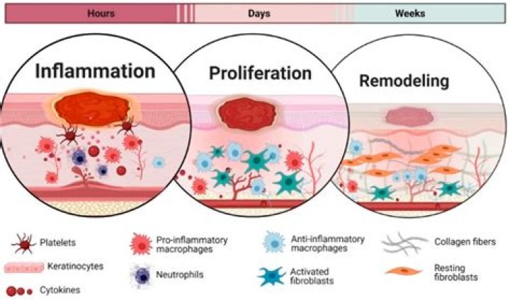 Do anti inflammatories delay healing?