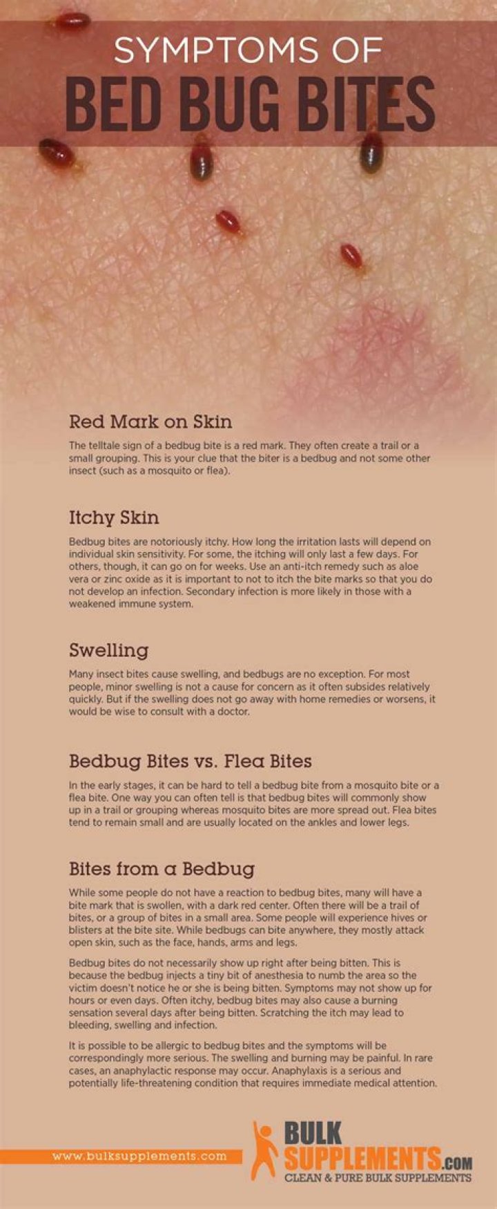Do bedbugs bite every night?