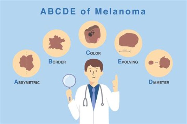 Do doctors miss melanoma?
