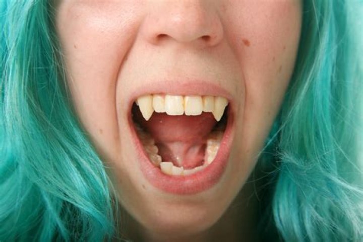 Do humans have fangs?