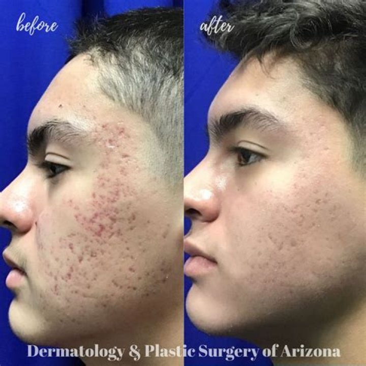 Do I need to see a dermatologist for scabies?