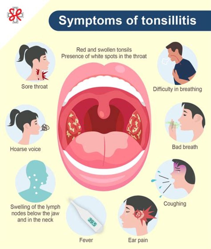 Do large tonsils cause more illness?