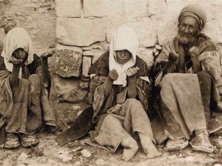 Do leper colonies still exist today?