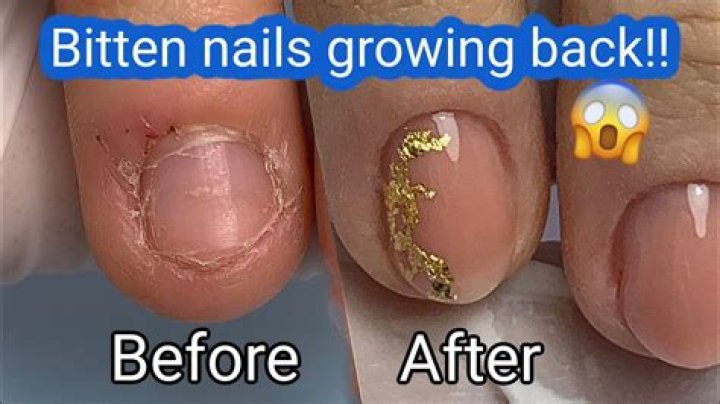 Do nail beds grow back after biting?