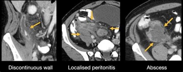 Do parasites show up on a CT scan?