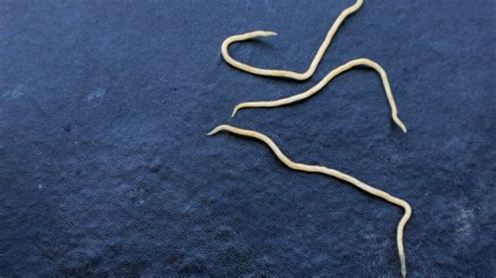 Do pinworms make you feel hungry?