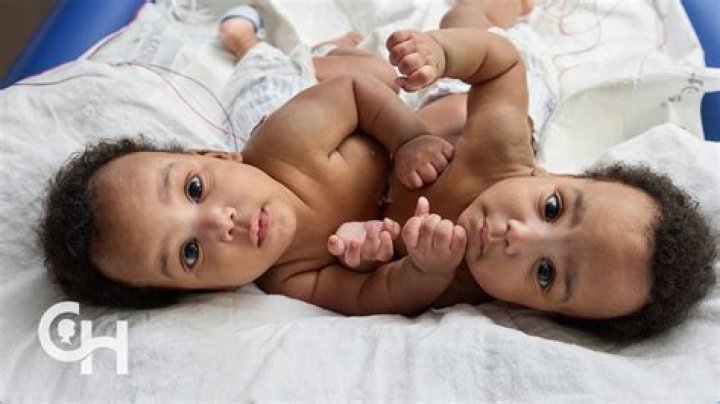 Do Wanda's twins exist?