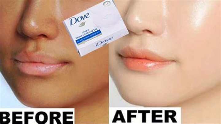 Does aloe vera gel whiten skin?