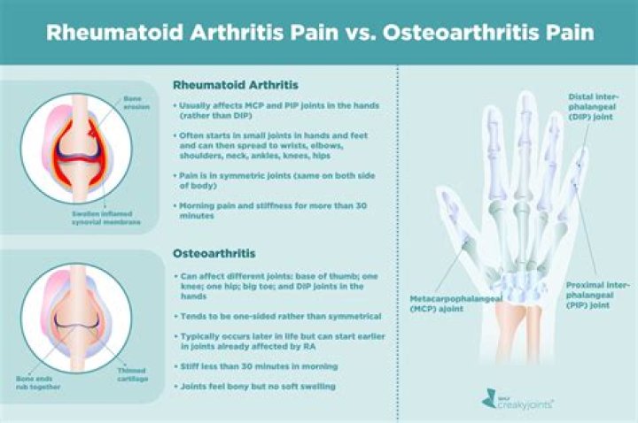 Does arthritis always show up in blood tests?