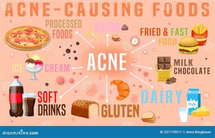 Does bread cause acne?