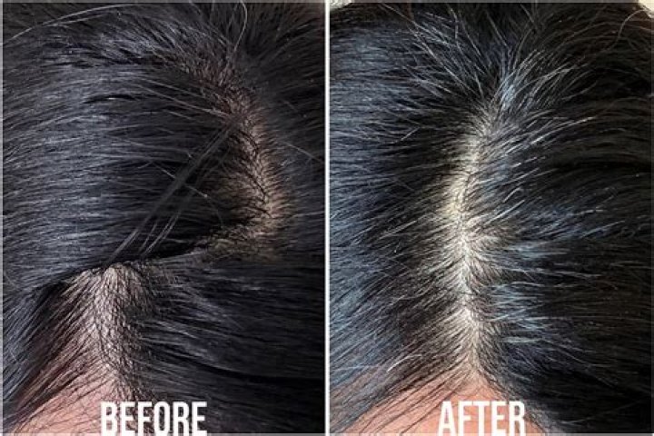 Does castor oil cause grey hair?