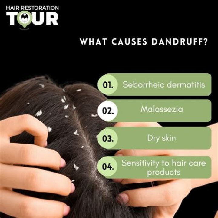 Does dandruff cause hair fall?