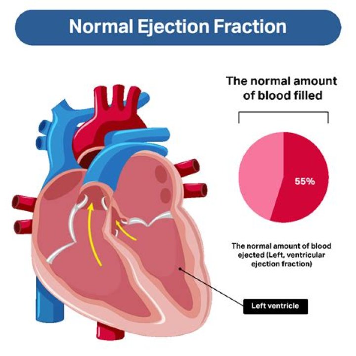 Does ejection fraction affect blood pressure?