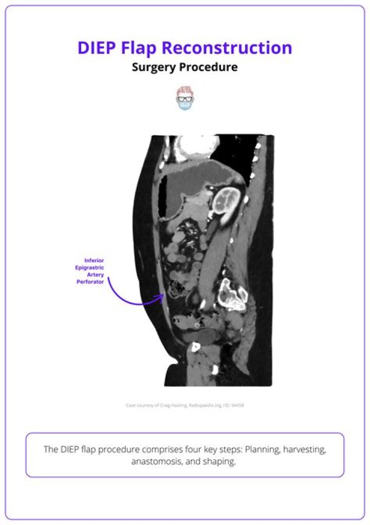 Does flap surgery hurt?