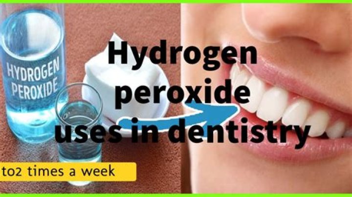 Does hydrogen peroxide help tooth pain?