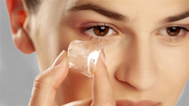 Does ice clear skin?