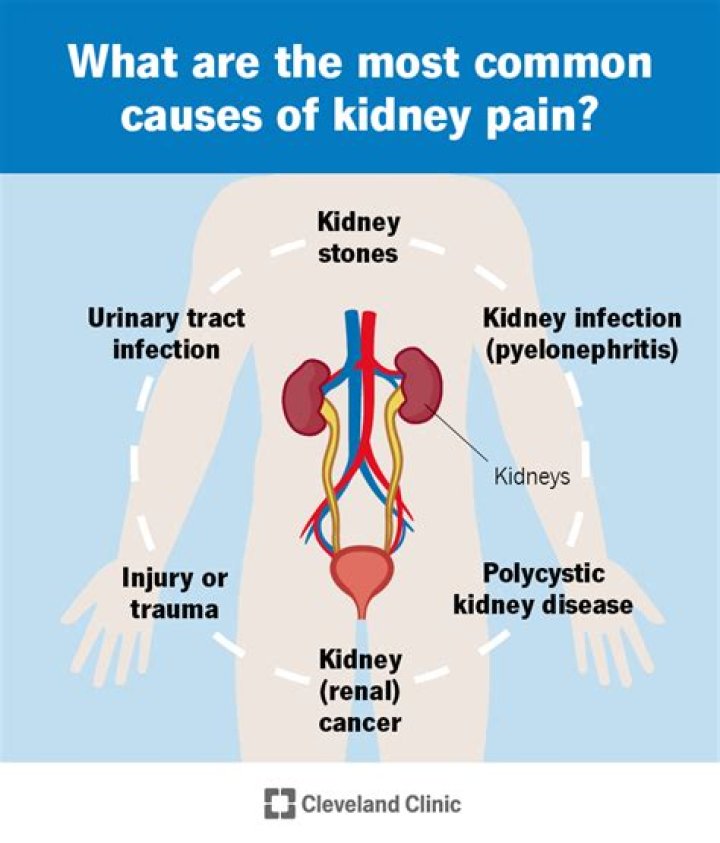Does kidney pain go away?
