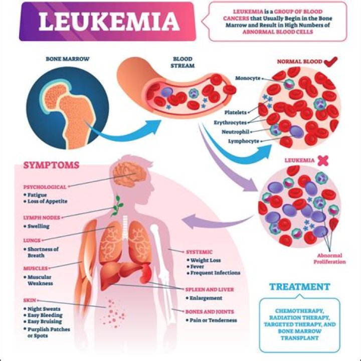 Does leukemia feel like the flu?
