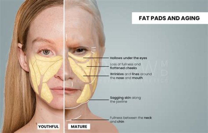 Does losing weight make face look younger?