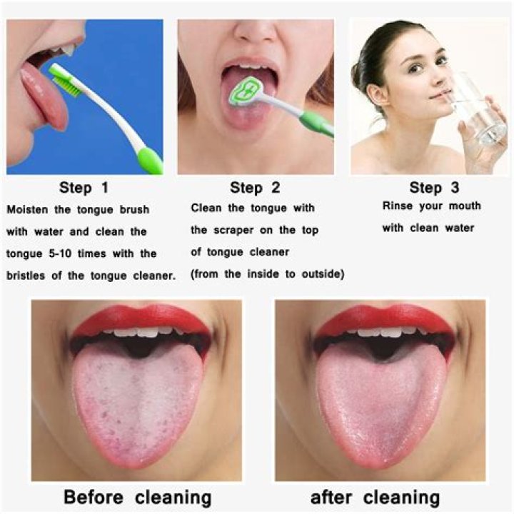 Does mouthwash clean tongue?