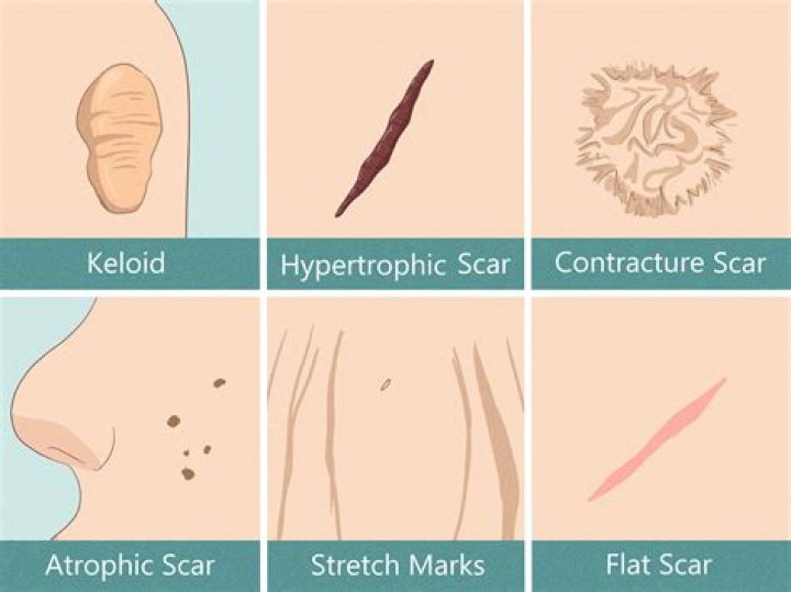 Does scar tissue feel like lumps?