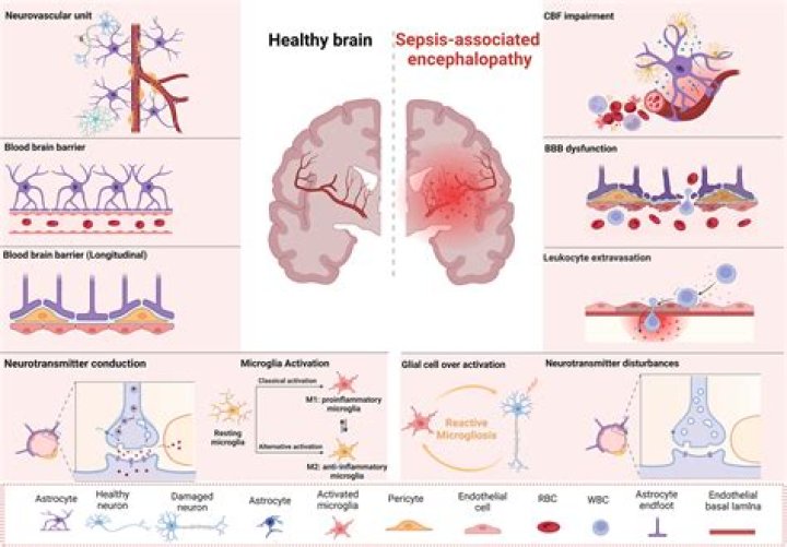 Does sepsis cause brain damage?