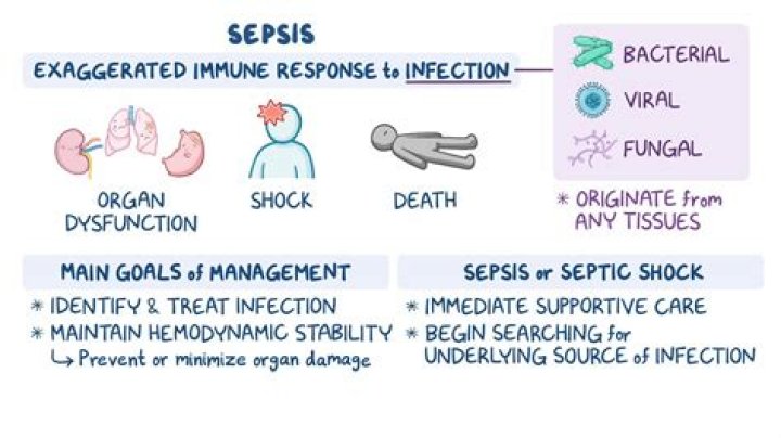 Does sepsis come on suddenly?