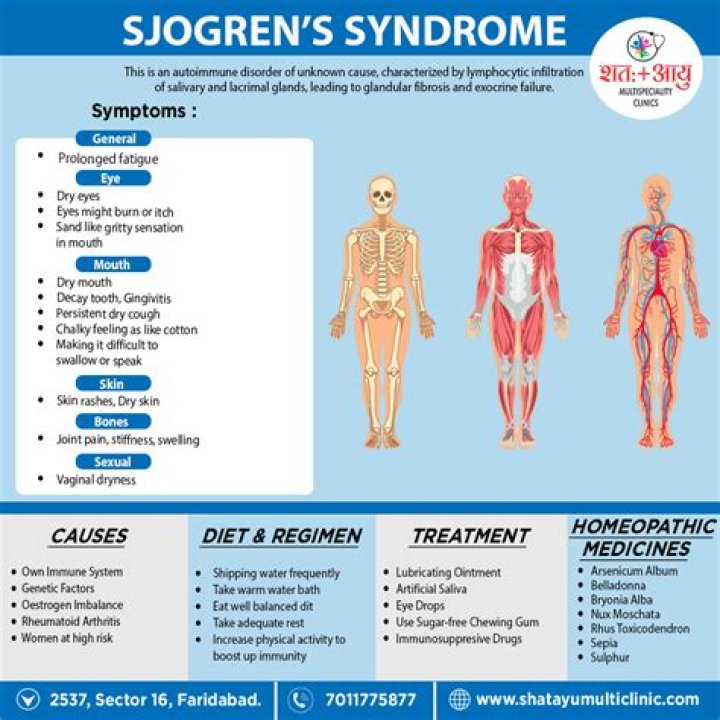 Does Sjogren's cause dementia?