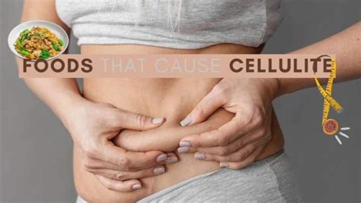 Does sugar cause cellulite?
