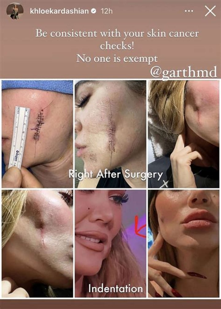Does surgery stink?