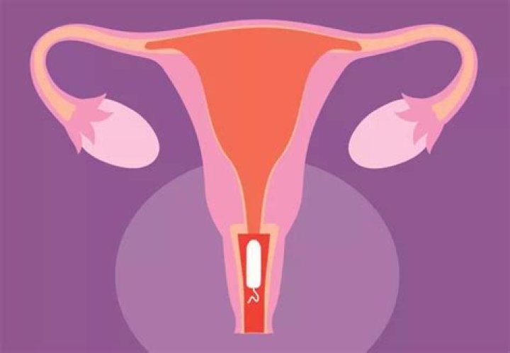 Does tampon touch cervix?