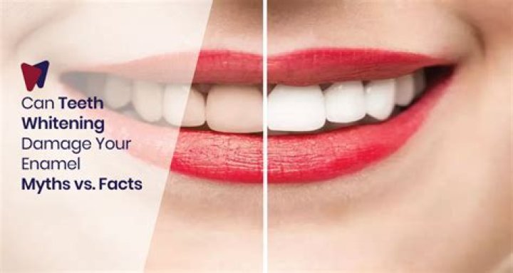 Does whitening damage teeth?