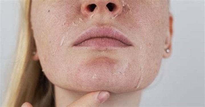 Does your skin change every 7 years?