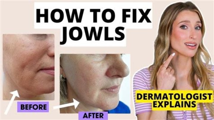 How can I reduce my round face?
