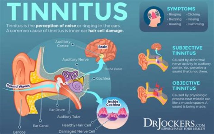 How can I relax my jaw from tinnitus?
