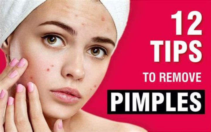 How can I remove pimples?