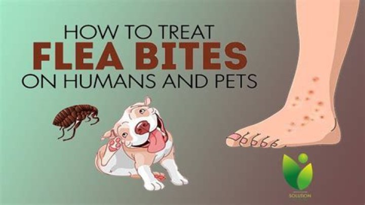 How can I stop being bitten by fleas?