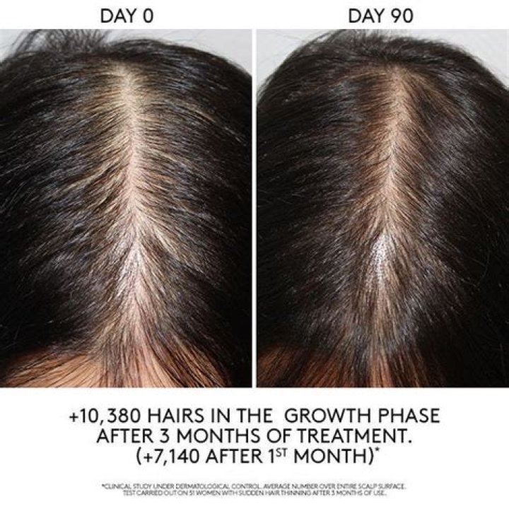 How can I tell if my hair is thinning?