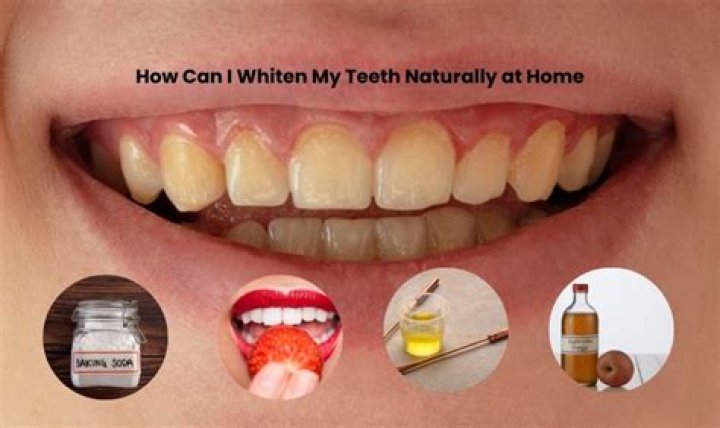 How can I whiten my teeth without soda?