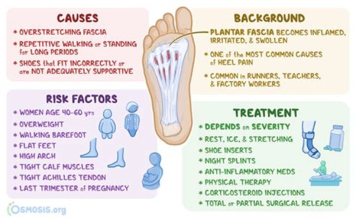 How can you tell the difference between plantar fasciitis and neuropathy?