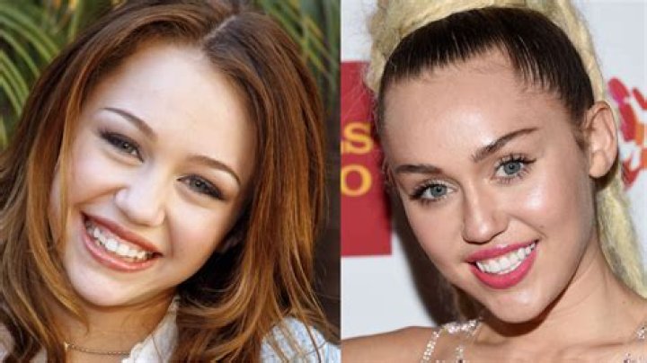How do celebrities have white teeth?