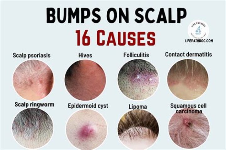 How do I get rid of crusty build up on my scalp?