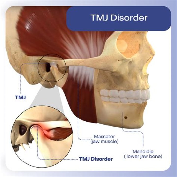 How do I know if I have TMJ or tinnitus?