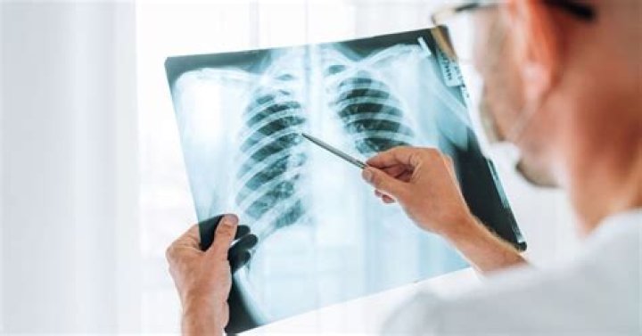 How do I know if my chest infection is viral or bacterial?