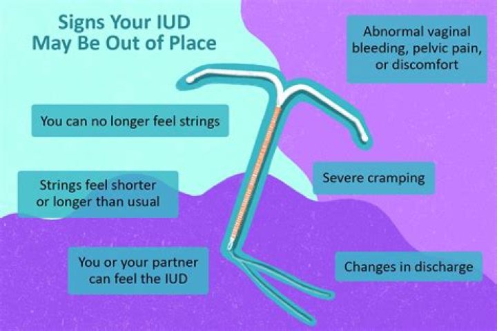 How do I know my IUD is out of place?